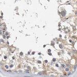 CTH Antibody in Immunohistochemistry (Paraffin) (IHC (P))