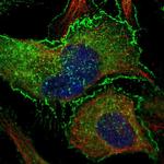 BAIAP2 Polyclonal Antibody