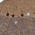 BAIAP2 Antibody in Immunohistochemistry (Paraffin) (IHC (P))