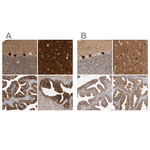 BAIAP2 Antibody in Immunohistochemistry (Paraffin) (IHC (P))
