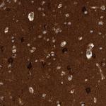 BAIAP2 Antibody in Immunohistochemistry (Paraffin) (IHC (P))