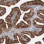 BAIAP2 Antibody in Immunohistochemistry (Paraffin) (IHC (P))