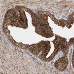 BAIAP2 Antibody in Immunohistochemistry (Paraffin) (IHC (P))