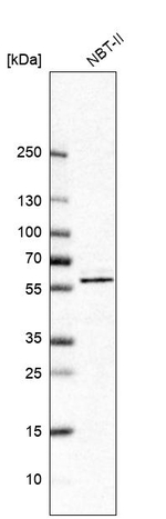 BAIAP2 Antibody in Western Blot (WB)