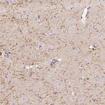 CNP Antibody in Immunohistochemistry (Paraffin) (IHC (P))