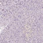 CNP Polyclonal Antibody