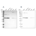 CNP Antibody in Western Blot (WB)