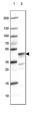 CNP Antibody in Western Blot (WB)