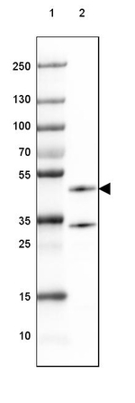 CNP Antibody in Western Blot (WB)