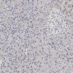 DCXR Polyclonal Antibody