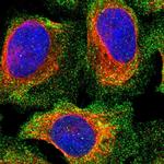 PPP3CC Polyclonal Antibody