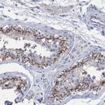 PPP3CC Antibody in Immunohistochemistry (Paraffin) (IHC (P))