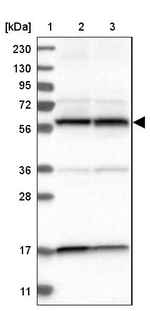 PPP3CC Antibody in Western Blot (WB)