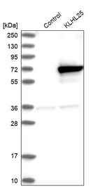 ENC-2 Antibody in Western Blot (WB)