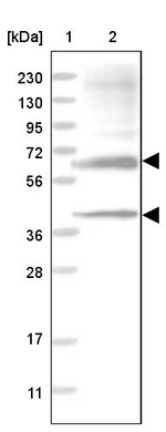 SGSH Antibody in Western Blot (WB)