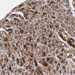 MRPS23 Antibody in Immunohistochemistry (Paraffin) (IHC (P))