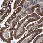 TRIM68 Antibody in Immunohistochemistry (Paraffin) (IHC (P))