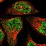 ZBTB2 Polyclonal Antibody