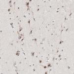 ZBTB2 Antibody in Immunohistochemistry (Paraffin) (IHC (P))