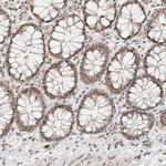 ZBTB2 Antibody in Immunohistochemistry (Paraffin) (IHC (P))