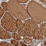 ZBTB2 Antibody in Immunohistochemistry (Paraffin) (IHC (P))
