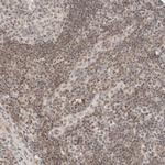 ZBTB2 Antibody in Immunohistochemistry (Paraffin) (IHC (P))