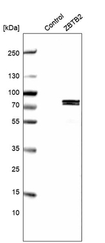 ZBTB2 Antibody in Western Blot (WB)