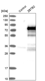 ZBTB2 Antibody in Western Blot (WB)