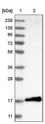 4EBP1 Antibody in Western Blot (WB)