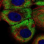 ZNF23 Polyclonal Antibody