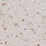 DAP3 Antibody in Immunohistochemistry (Paraffin) (IHC (P))