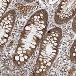 DAP3 Antibody in Immunohistochemistry (Paraffin) (IHC (P))