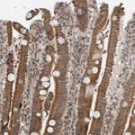 DAP3 Antibody in Immunohistochemistry (Paraffin) (IHC (P))