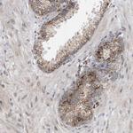 DAP3 Antibody in Immunohistochemistry (Paraffin) (IHC (P))