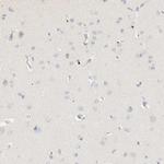 C8B Antibody in Immunohistochemistry (Paraffin) (IHC (P))