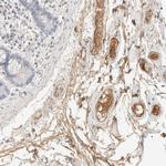 C8B Polyclonal Antibody