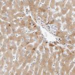 C8B Antibody in Immunohistochemistry (Paraffin) (IHC (P))