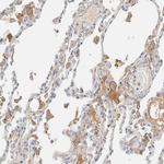 C8B Antibody in Immunohistochemistry (Paraffin) (IHC (P))