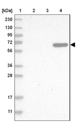 C8B Antibody in Western Blot (WB)