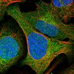 GCLM Antibody in Immunocytochemistry (ICC/IF)