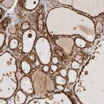 GCLM Antibody in Immunohistochemistry (Paraffin) (IHC (P))