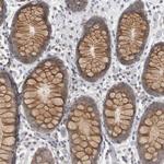 MSRA Antibody in Immunohistochemistry (Paraffin) (IHC (P))