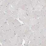 MSRA Antibody in Immunohistochemistry (Paraffin) (IHC (P))