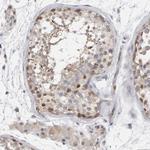 MSRA Polyclonal Antibody