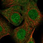 Syntenin 1 Polyclonal Antibody