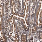 Syntenin 1 Antibody in Immunohistochemistry (Paraffin) (IHC (P))