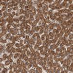 Syntenin 1 Antibody in Immunohistochemistry (Paraffin) (IHC (P))