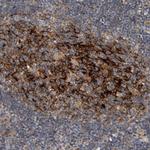 Syntenin 1 Antibody in Immunohistochemistry (Paraffin) (IHC (P))