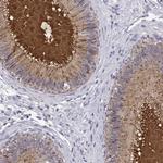 SPAG11B Polyclonal Antibody