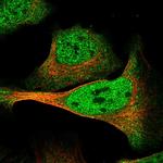 DMTF1 Polyclonal Antibody